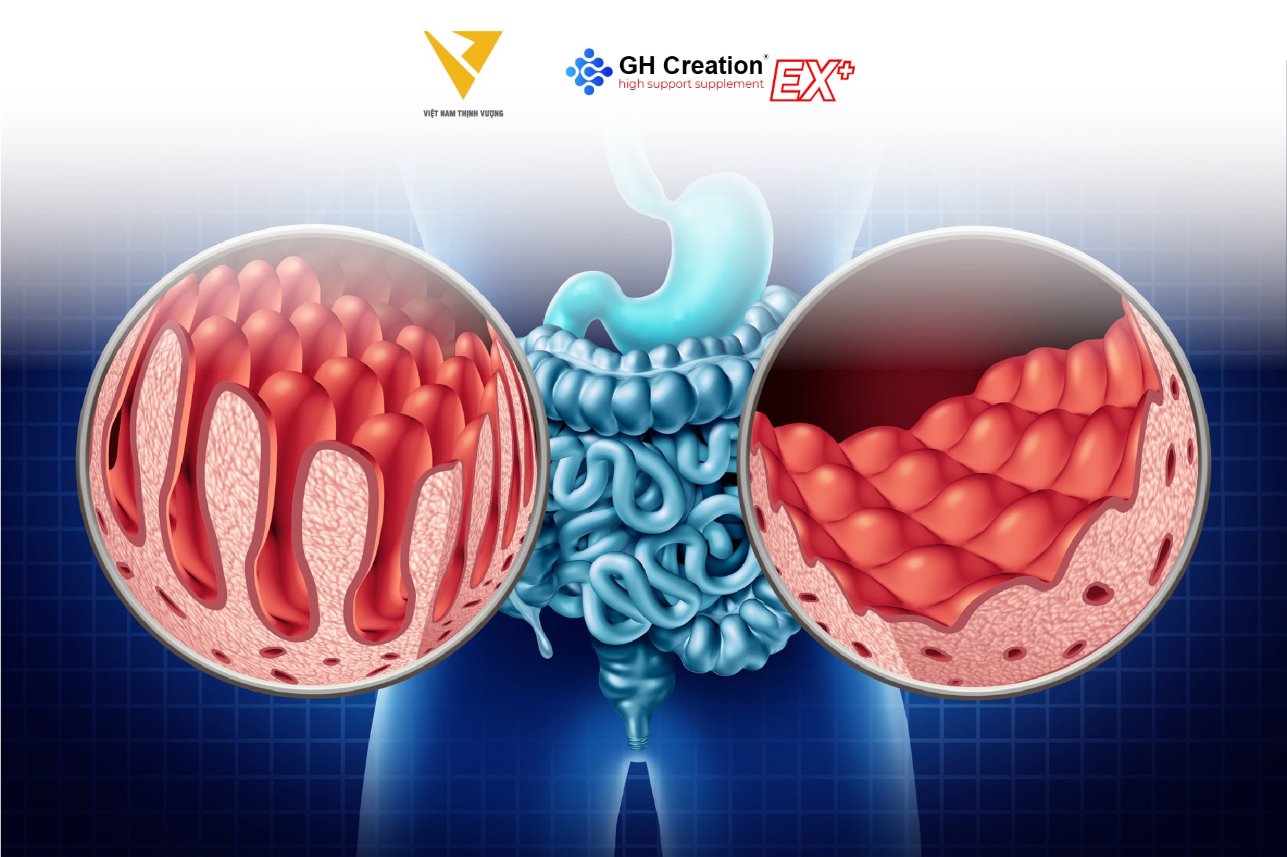 Bệnh Celiac một bệnh lý điển hình tác động trực tiếp đến vấn đề tăng chiều cao của trẻ Bệnh Celiac một bệnh lý điển hình tác động trực tiếp đến vấn đề tăng chiều cao của trẻ